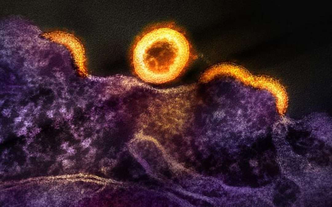 Kidney transplants for recipients with HIV is safe