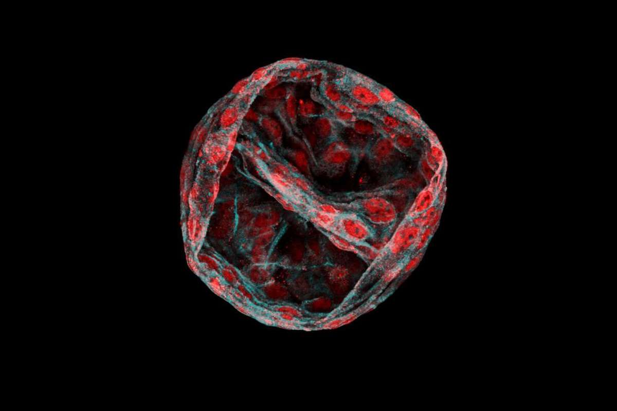enzyme cancer target