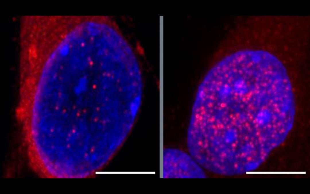 Pathway to neurodegeneration in early stages of ALS identified