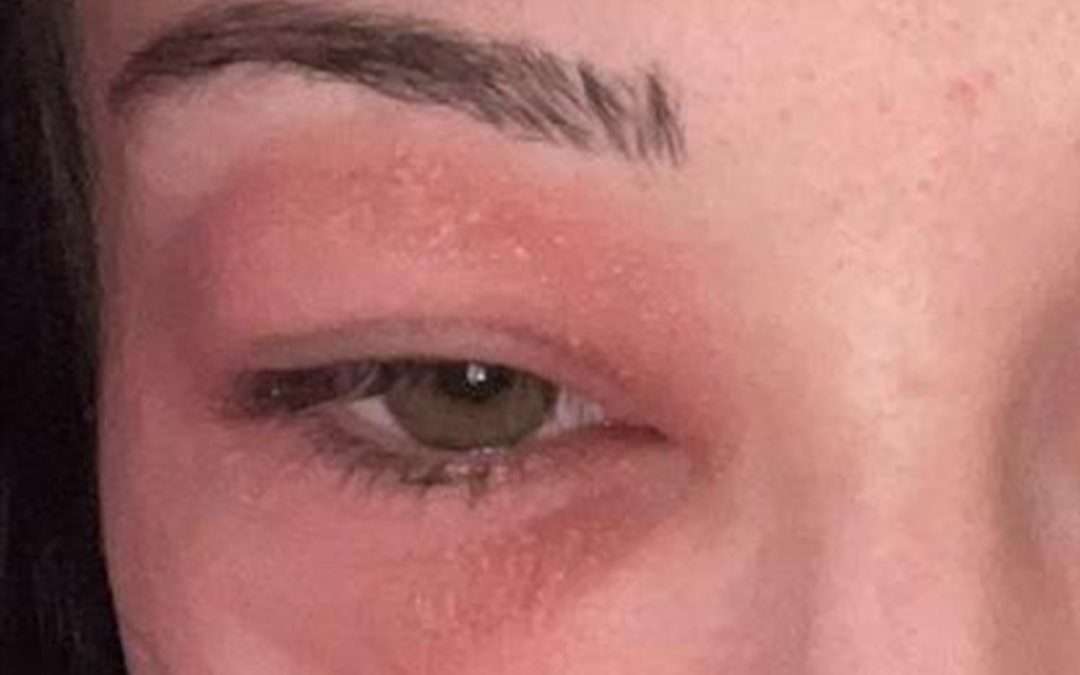 TikTok teen skin routines are harmful